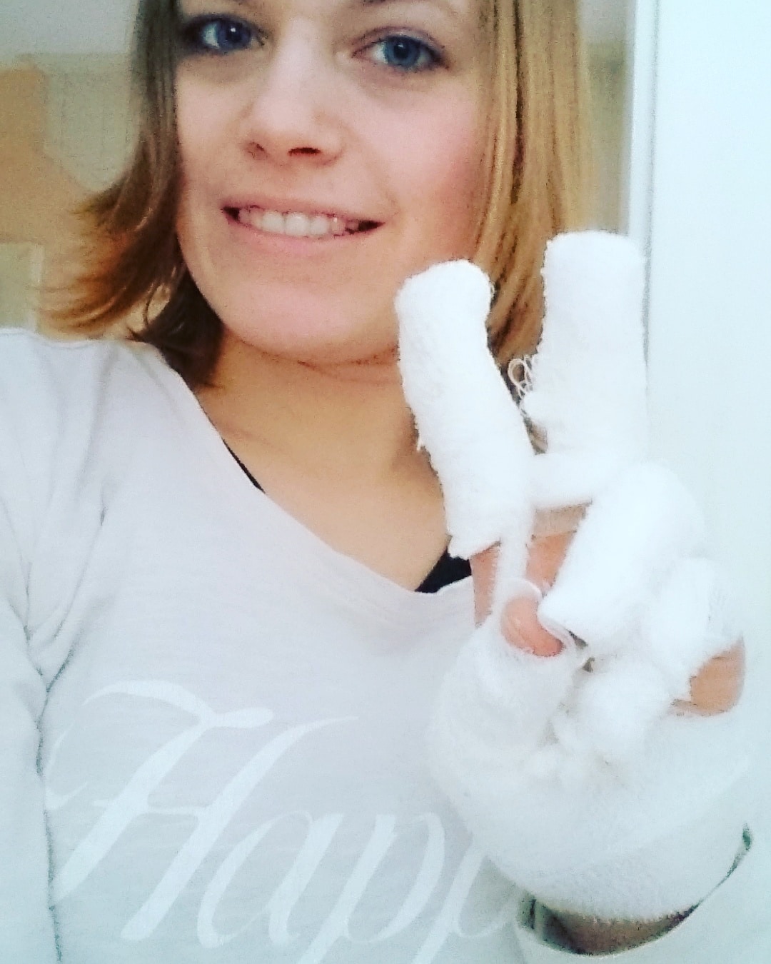 verbrennung backofen narbe